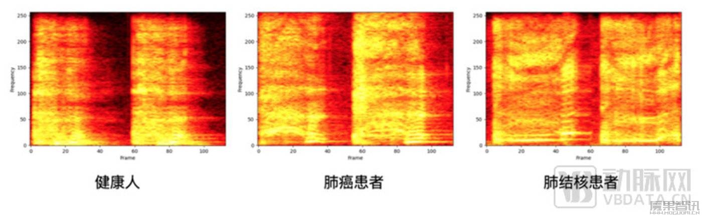 谷歌大模型下场,FDA完成首批,这个AI赛道起飞在即插图 谷歌大模型下场,FDA完成首批,这个AI赛道起飞在即