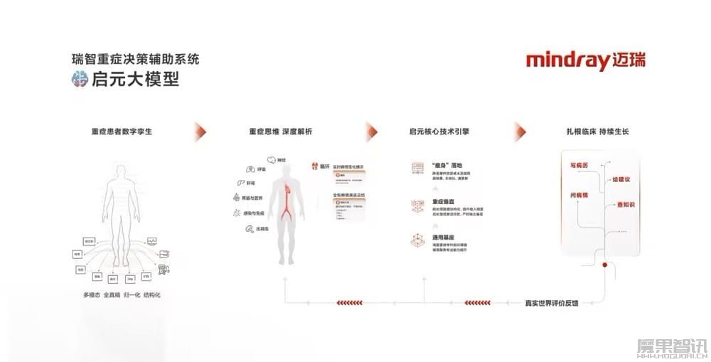 全球首个重症医疗大模型:腾讯 X 迈瑞发布“启元重症大模型”,已用于 ICU 病房插图1 全球首个重症医疗大模型:腾讯 X 迈瑞发布“启元重症大模型”,已用于 ICU 病房