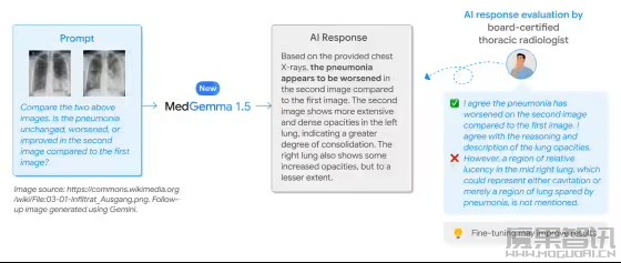 谷歌发布医疗 AI 模型 MedGemma 1.5 4B：可本地部署，CT、MRI 都能处理