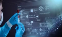 麻省理工推出两款名为“PRISM”的AI模型 可更早检测出胰腺癌